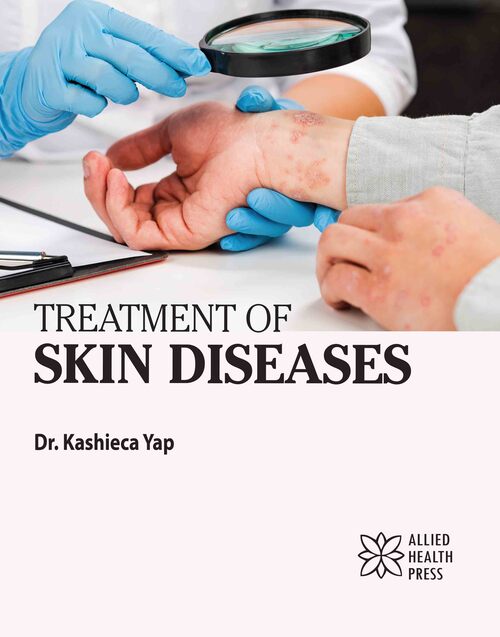 Treatment of Skin Diseases 